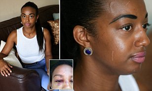 Lady beaten up by another lady because she was more prettier.